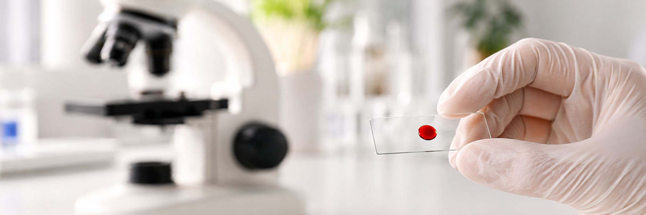 live & dry blood microscopy